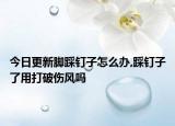 今日更新脚踩钉子怎么办,踩钉子了用打破伤风吗