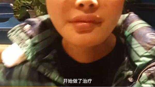 24岁女孩花4万元整容下颌手术变歪嘴，哭诉我还没有结婚呢