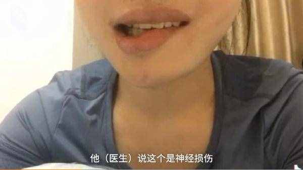 24岁女孩花4万元整容下颌手术变歪嘴，哭诉我还没有结婚呢
