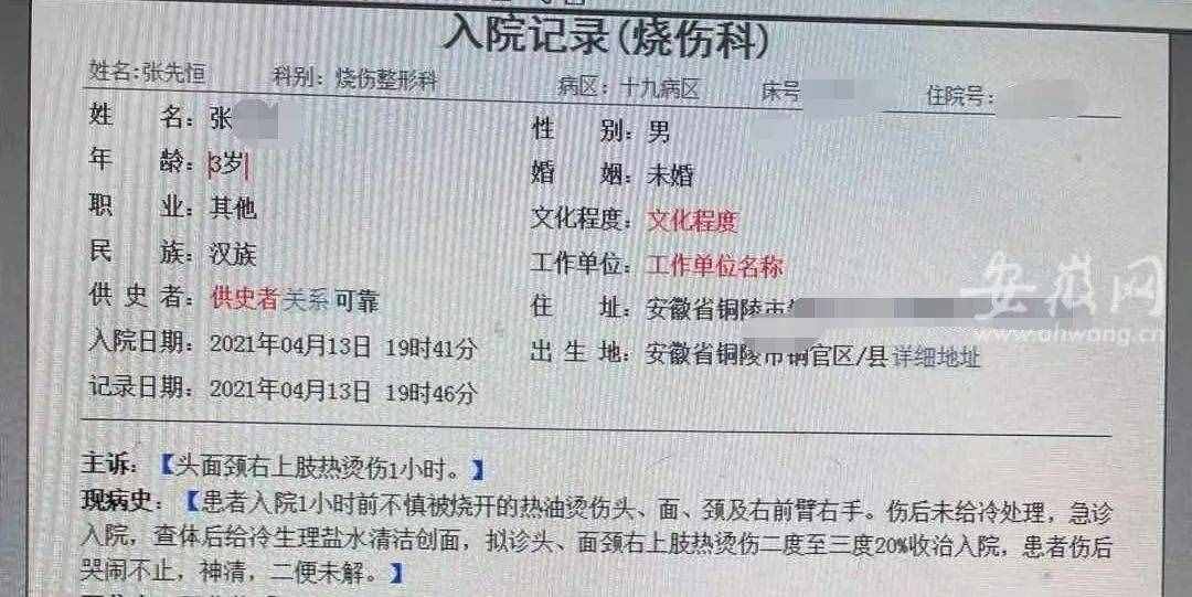 太揪心！一锅热油从2岁宝宝头上浇下，事发铜陵