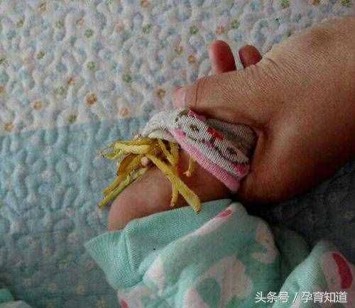 分享一个专治感冒流鼻涕的小偏方，成本不到1元哦，马上收藏转发