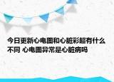 今日更新心电图和心脏彩超有什么不同 心电图异常是心脏病吗