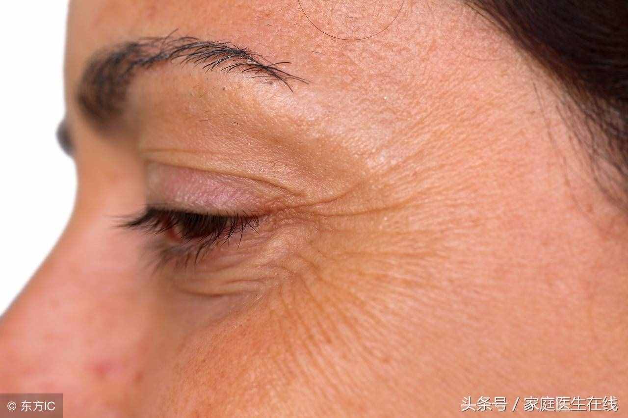 皱纹悄悄爬上眼角？5个妙招抚平皱纹，年轻十岁！