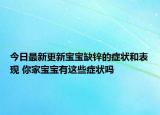 今日最新更新宝宝缺锌的症状和表现 你家宝宝有这些症状吗