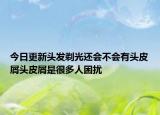 今日更新头发剃光还会不会有头皮屑头皮屑是很多人困扰