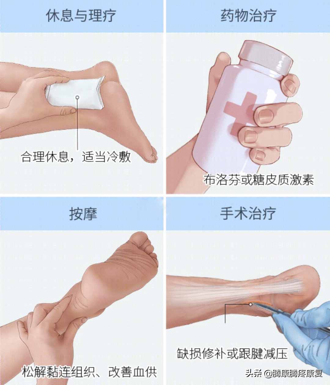 跟腱炎的分析与诊疗
