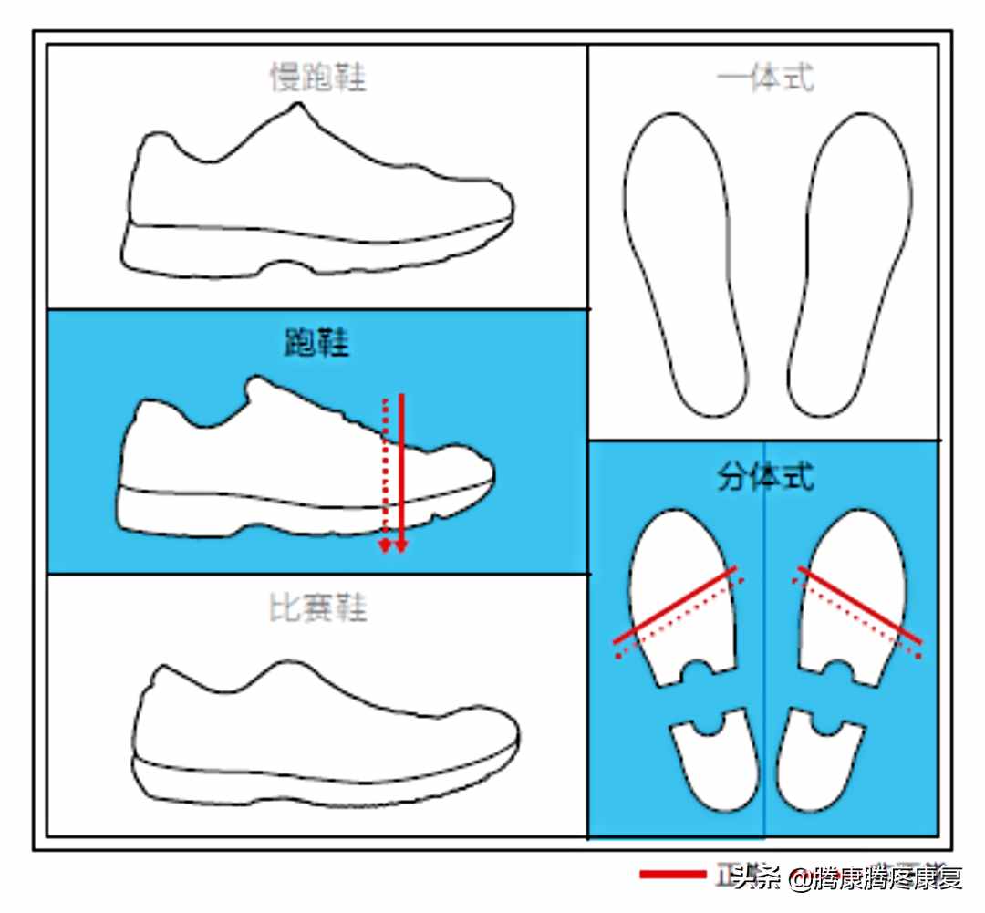 跟腱炎的分析与诊疗