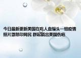 今日最新更新美国在吃人血馒头一组疫情照片激怒印网民 群起戳出美国伤疤