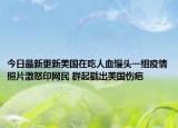 今日最新更新美国在吃人血馒头一组疫情照片激怒印网民 群起戳出美国伤疤