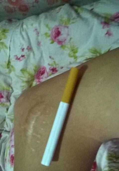 怎样做可以促进伤口的愈合呢？