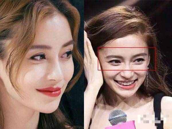 迪丽热巴都消不掉的眼纹，你想靠眼霜和按摩就消掉？