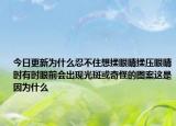 今日更新为什么忍不住想揉眼睛揉压眼睛时有时眼前会出现光斑或奇怪的图案这是因为什么