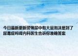 今日最新更新警惕尿中有大量泡沫是到了尿毒症吗肾内科医生告诉你准确答案