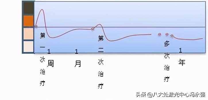 光子嫩肤——祛斑的心路历程