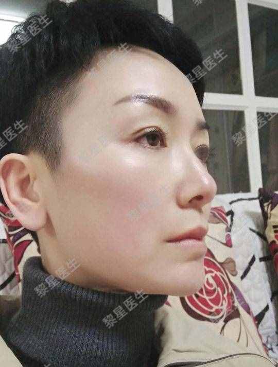 面部凹陷，皮肤松弛，像颗缺水的葡萄干，怎么办？