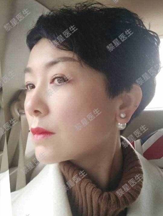 面部凹陷，皮肤松弛，像颗缺水的葡萄干，怎么办？