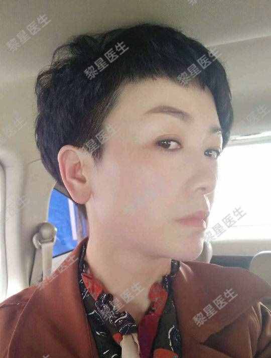 面部凹陷，皮肤松弛，像颗缺水的葡萄干，怎么办？