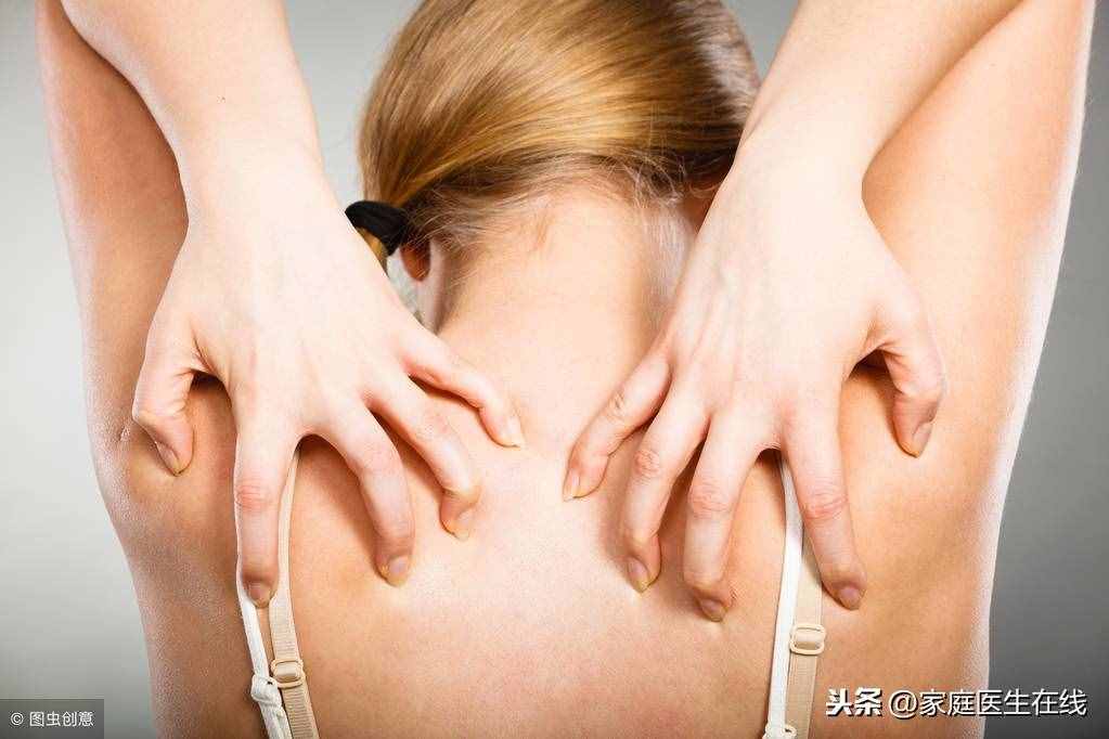 如何应对螨虫性皮炎？皮肤科医生给出了建议！不防听一听