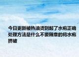 今日更新被热油烫到起了水疱正确处理方法是什么不要随意的将水疱挤破