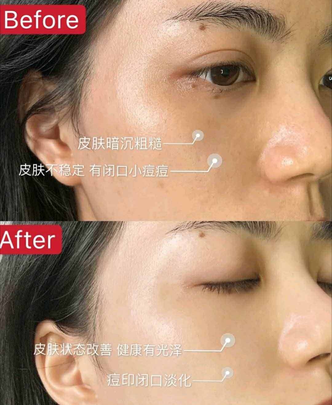 原来精华液不是直接涂？难怪涂了没效果！快来看看正确的使用方法