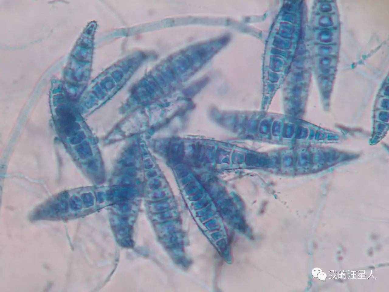 狗狗得了真菌性皮肤病该怎么办？