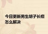 今日更新男生胡子长痘怎么解决