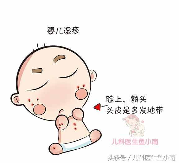 虽然只有一字之差，但宝宝湿疹热疹大不同，医生教辨别和护理方法