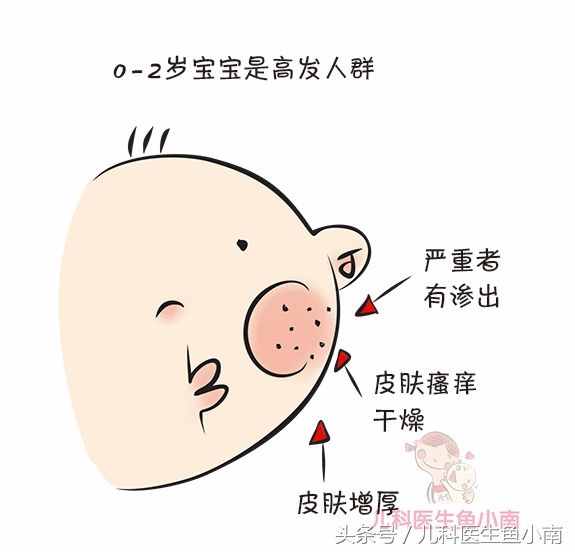 虽然只有一字之差，但宝宝湿疹热疹大不同，医生教辨别和护理方法
