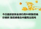 今日最新更新全球约有80例猴痘确诊病例 猴痘病毒在中国有出现吗