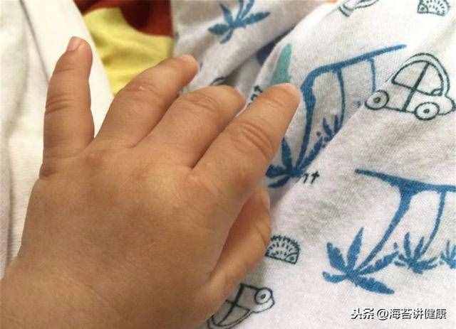 手上老是长“小水泡”？可能是这里出了问题，别再傻傻忽视了