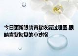 今日更新眼睛青紫恢复过程图,眼睛青紫恢复的小妙招