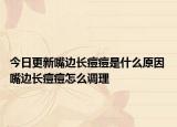 今日更新嘴边长痘痘是什么原因 嘴边长痘痘怎么调理