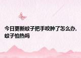 今日更新蚊子把手咬肿了怎么办,蚊子怕热吗