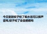 今日更新蚊子咬了起水泡可以摸芦荟吗,蚊子咬了会留疤痕吗
