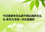 今日更新冬天头皮干燥头屑多怎么办,冬天几天洗一次头发最好