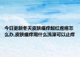 今日更新冬天皮肤瘙痒起红疙瘩怎么办,皮肤瘙痒用什么洗澡可以止痒