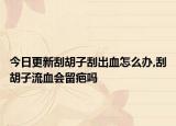 今日更新刮胡子刮出血怎么办,刮胡子流血会留疤吗
