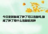 今日更新脚崴了肿了可以泡脚吗,脚崴了肿了用什么泡脚能消肿
