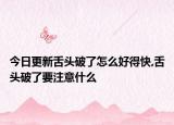 今日更新舌头破了怎么好得快,舌头破了要注意什么