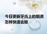 今日更新牙齿上的烟渍怎样快速去除
