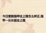 今日更新指甲往上翘怎么矫正,指甲一长长就往上翘