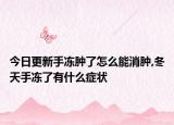 今日更新手冻肿了怎么能消肿,冬天手冻了有什么症状