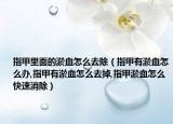 指甲里面的淤血怎么去除（指甲有淤血怎么办,指甲有淤血怎么去掉,指甲淤血怎么快速消除）