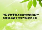 今日更新手背上的血管凸起来是什么原因,手背上血管凸起来怎么办