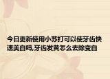 今日更新使用小苏打可以使牙齿快速美白吗,牙齿发黄怎么去除变白