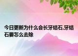 今日更新为什么会长牙结石,牙结石要怎么去除