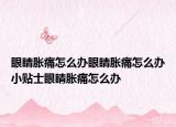眼睛胀痛怎么办眼睛胀痛怎么办小贴士眼睛胀痛怎么办