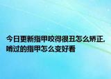 今日更新指甲咬得很丑怎么矫正,啃过的指甲怎么变好看