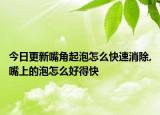 今日更新嘴角起泡怎么快速消除,嘴上的泡怎么好得快