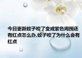 今日更新蚊子咬了变成紫色周围还有红点怎么办,蚊子咬了为什么会有红点
